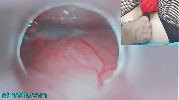 Fresh Uncensored Japanese Insemination with Cum into Uterus and Endoscope Camera by Cervix to watch inside womb total Movies